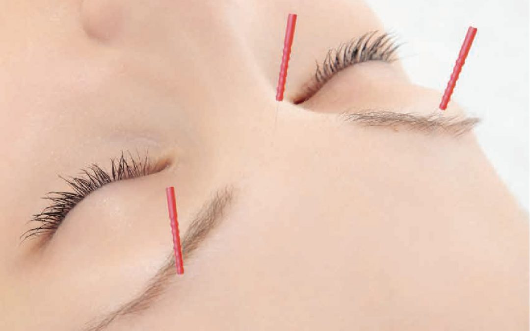 J-15 Short Needle with Guide Tube